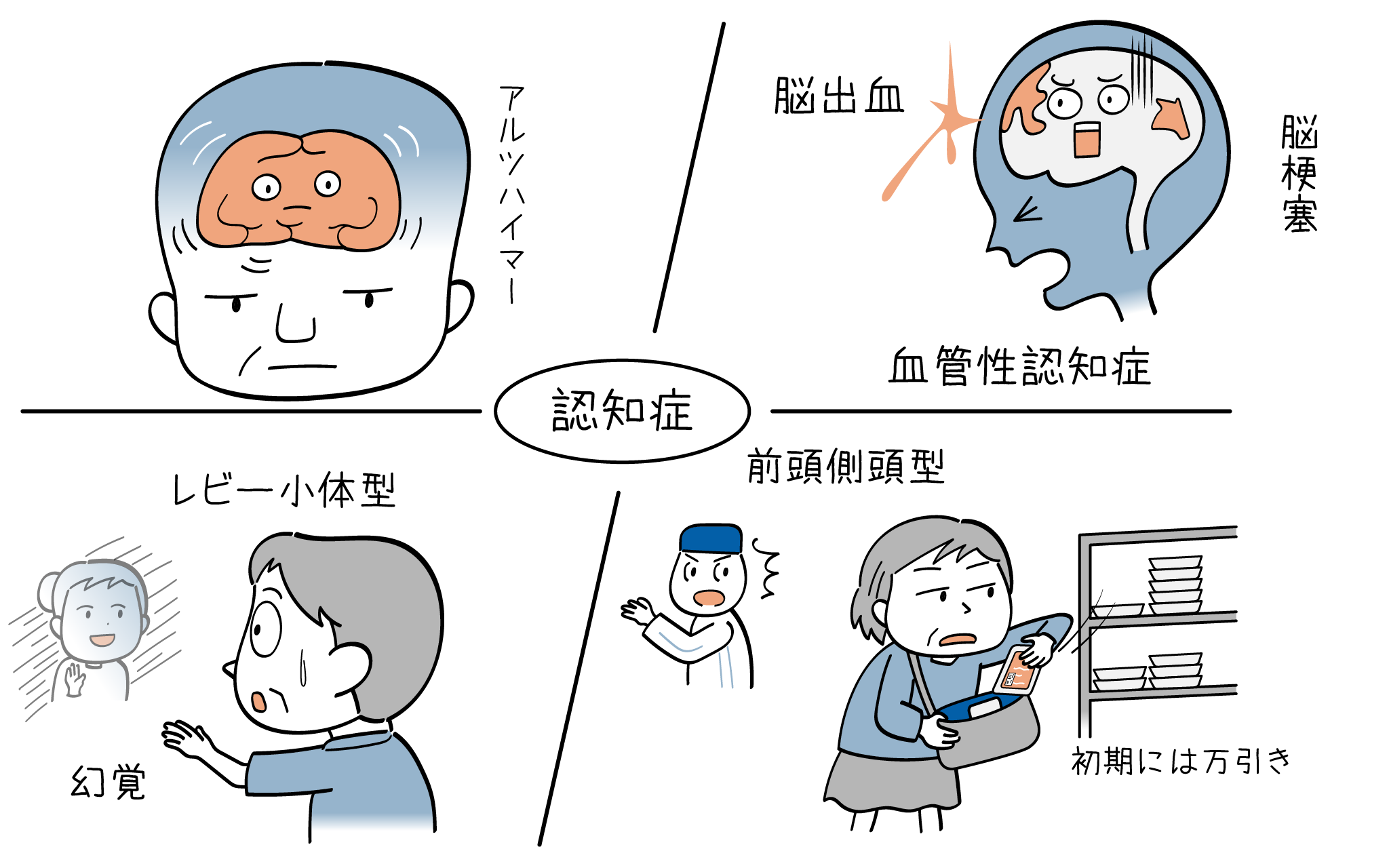 4つの種類の認知症について、概要をまとめて、精神科医がご紹介していきます。
